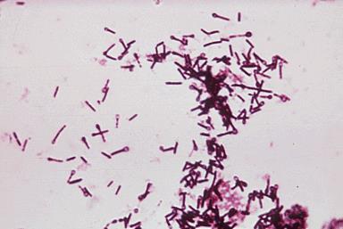 Station 3 Gram Stain (Gram Positive and Gram Negative) Be able to recognize the
