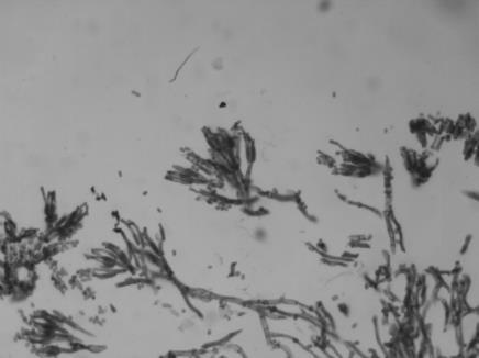 Why are these fungi considered to be imperfect? Why are they now placed in the Ascomycetes? Penicillium notatum Aspergillus niger Station 25 Division: Ascomycetes Imperfect Fungi 1.