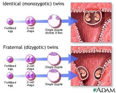 Some background notes Monozygotic twins: twins
