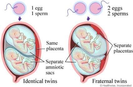 two 1 sperm, 1 egg Dizygotic twins: twins that