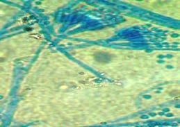 endophytes (A) Aspergillus niger;