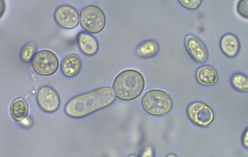Figure 6. Baker s yeast cells after 48hr incubation.