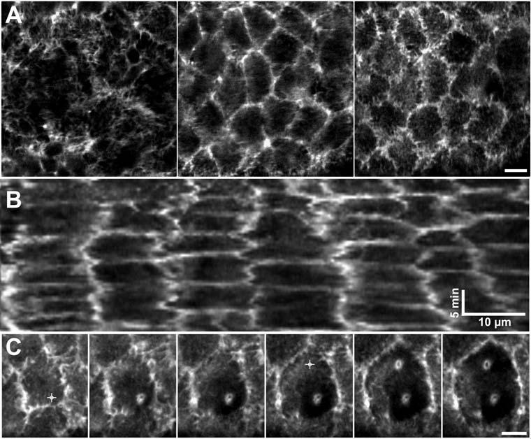 Figure 7. The apical actin network in GFP-moesin embryos. (A) Confocal fluorescent images of amnioserosa cells taken in different imaging planes: basal, middle and apical (from left to right).