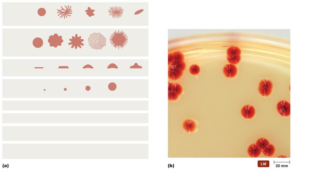 Figure 6.8 Characteristics of bacterial colonies.