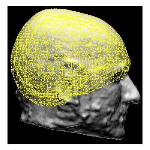 17 Sphere BEM FEM Figure 2.3. Volume conductor modeling of human head depending on how to model head geometry, how to assign tissue conductivity, and how to solve the forward problem numerically.