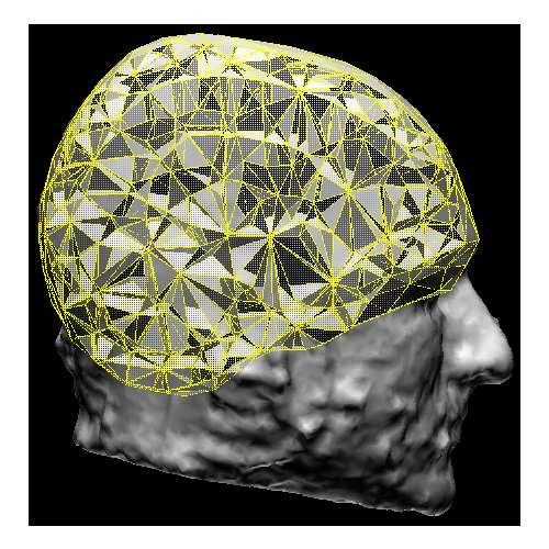 1 Realistic Geometric Modeling Current medical imaging techniques contribute to create an accurate volume conductor model and there are advantages and disadvantages to each modality.
