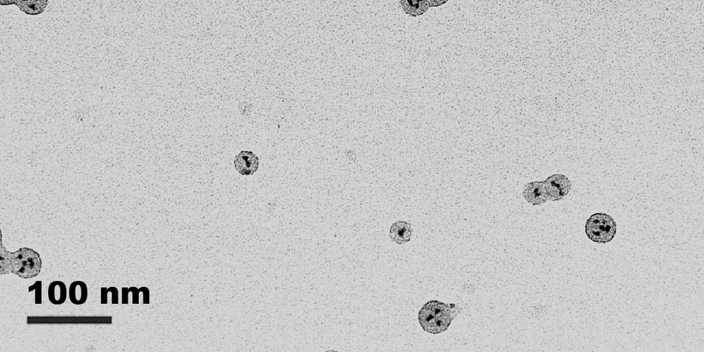 (Above) Low-magnification TEM image of