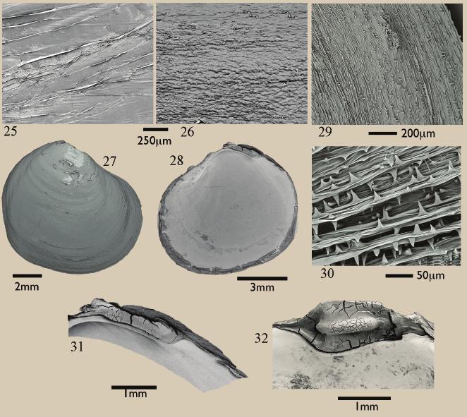 NEW SPECIES OF THYASIRIDAE IN ATLANTIC 181 Figures 25-32 Scanning electron micrographs of shells and shell structures. Fig. 25 Thyasira southwardae n. sp., periostracum Fig.