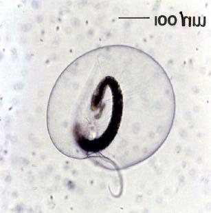 of Noctiluca cells
