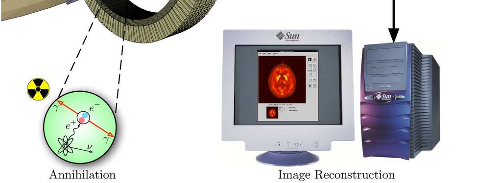 (Magnetic Resonance Imaging) CT (X-ray