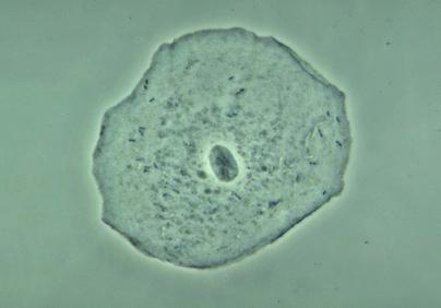 Microscope Image Human Cheek Cell This