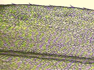 Microscope Images of Elodea Leaf 40