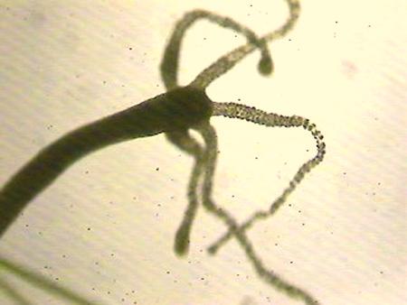 Microscope Images of Pond Organisms 40