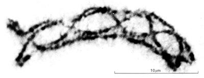 3) Anaphase I - Homologous pairs pulled to opposite