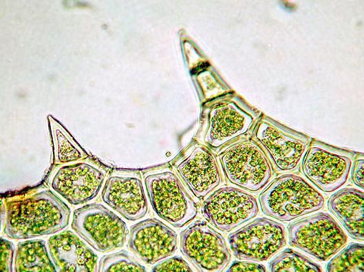 Leaf cells under a regular light microscope (400x) What is this?