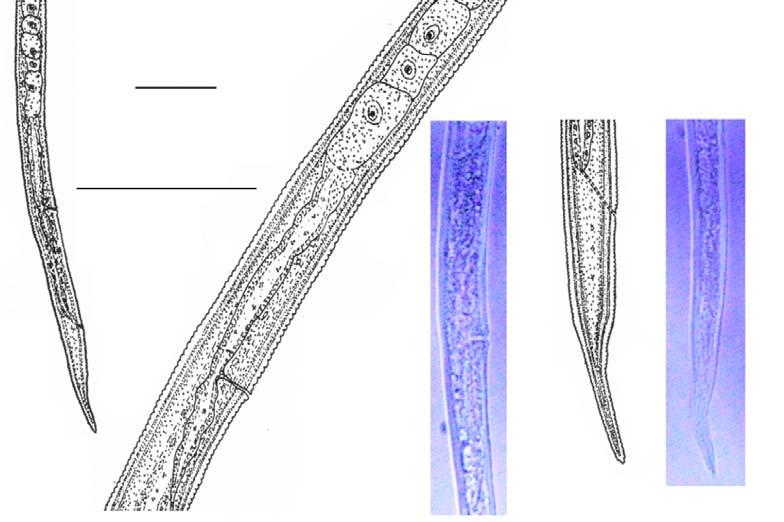 Anterior region, C.Reproductive system, D.Tail region, E.