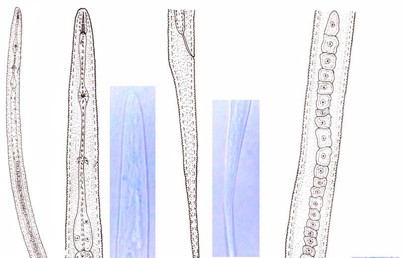 A B D C F H I G E J A 21 µm B, C, D, E 17 µm Figure 4: Tylenchus imphalus sp.