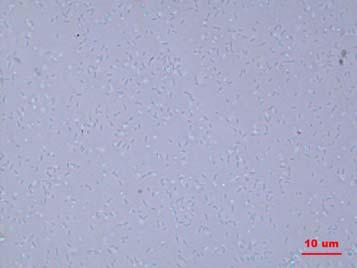 Bright field microscopy (Light field) Even at 1000X