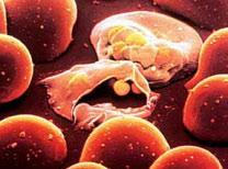 AA + AS + SA + SS 50% are resistant and live malaria sickle cell disease Trait has evolved spontaneously and