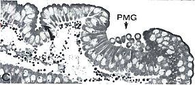 In the slide below of the PMG, note the group of cells within the