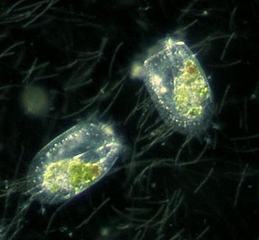 Ciliates inhabit almost all aquatic ecosystems on the planet, even into the soil (if the humidity is high enough).