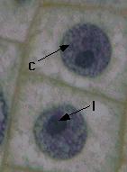 Key Features: 1. A sharp, round nucleus. 2. Any dark staining regions (nucleolus) 3.