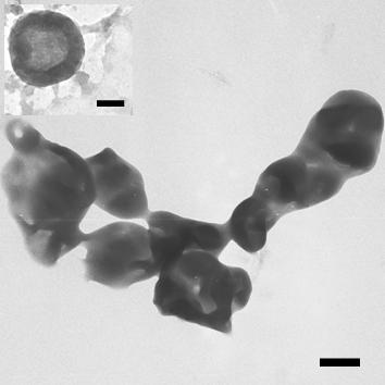 Additional TEM images Figure S4. OsO 4 stained TEM image of PBLG 50 -K polymersomes prepared in water by the common slow water addition followed by dialysis method. Inset PTA stained sample.