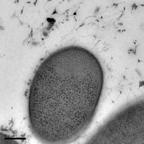 Bacteria Proteins in solution Microtubule Negative staining electron microscopy 3 ways to work with