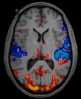 Functional MRI - Brain First fmri: blood-oxygen-level dependent (BOLD) contrast It measures brain activity by detecting hemodynamic responses the more the brain is active in an area, the more the