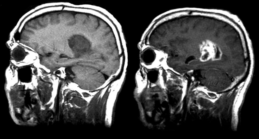 MRI contrast agent Contrast media used to improve the visibility of healthy or pathological