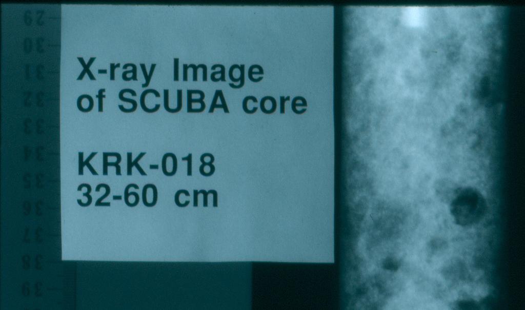 X-ray radiograph