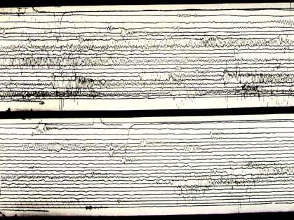 Richter s ups and Downs Richter scale advantages: First quantitative measure of energy release Can be computed minutes after an EQ Good for nearby, shallow, and moderate EQ s The Richter scale