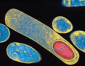 Endospores Some bacteria can transform into dormant state called an Endospore A way to survive difficult