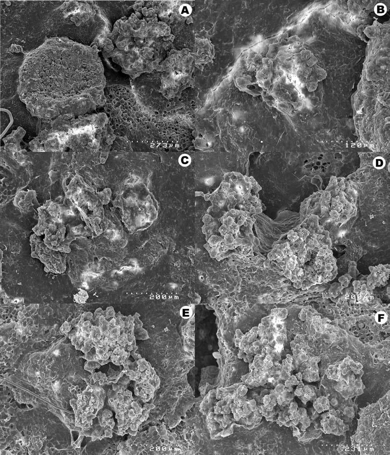 134 Herzogia 25 (2), 2012 Fig. 7: Scanning electron micrographs of Rinodina willeyi (all from Lendemer 23081). A apothecium and thallus. B D development of marginal soredia.