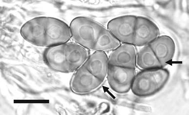 138 Herzogia 25 (2), 2012 Fig. 10: Mature Pachysporaria-type II ascospores of Rinodina bullata (Lendemer 17688). Arrows point to septal discs in different optical sections, tori not present.