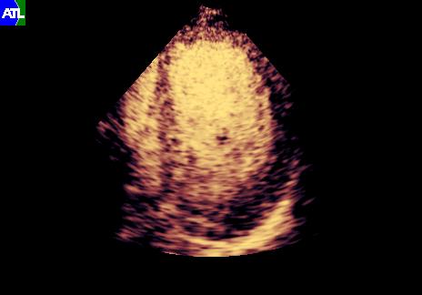 Ultrasound objective: diagnose