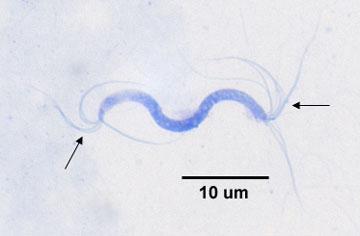 Fig. 8: Lophotrichous arrangement of flagella Fig. 9: Peritrichous arrangement of flagella Fig. 10 Axial filaments of a spirochete Fig.