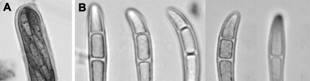 December, 2013 Joseph et al.: Syncesia farinacea new to India Fig. 3. Syncesia farinacea. A: An ascus (in Lugol s iodine). B: Ascospores (in Lugol s iodine). C: Section through a pycnidium.