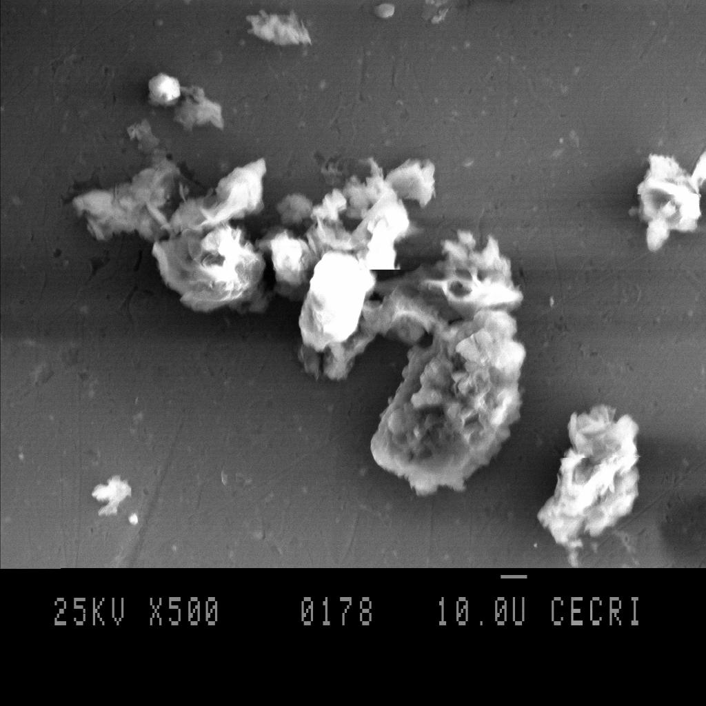 FIG. 9b SEM PHOTOGRAPH OF AIC AFTER Cu(II) ION ADSORPTION CONCLUSION The experimental data correlated reasonably well by the Langmuir and Freundlich adsorption isotherms and the isotherm parameters