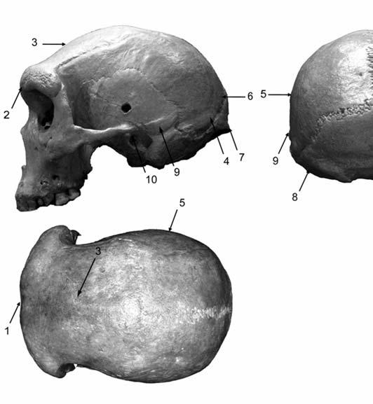 Table 2a: Diagnosis features of Homo heidelbergensis on the face Figure 4a: Morphological features of the revised diagnosis of Homo heidelbergensis Schoetensack, 1908. See details in Table 2a.