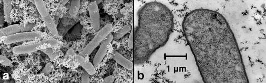 How would you determine the third dimension of the organism on the slide? 8. Which micrograph (A or B) is from a scanning electron microscope?