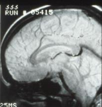 MRI contrast