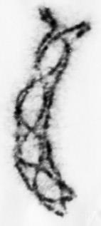 Anaphase I: The spindle fibers drag the homologous chromosome pairs away from each other, towards opposite poles of the cell. *Note that no centromeres are broken in this process.