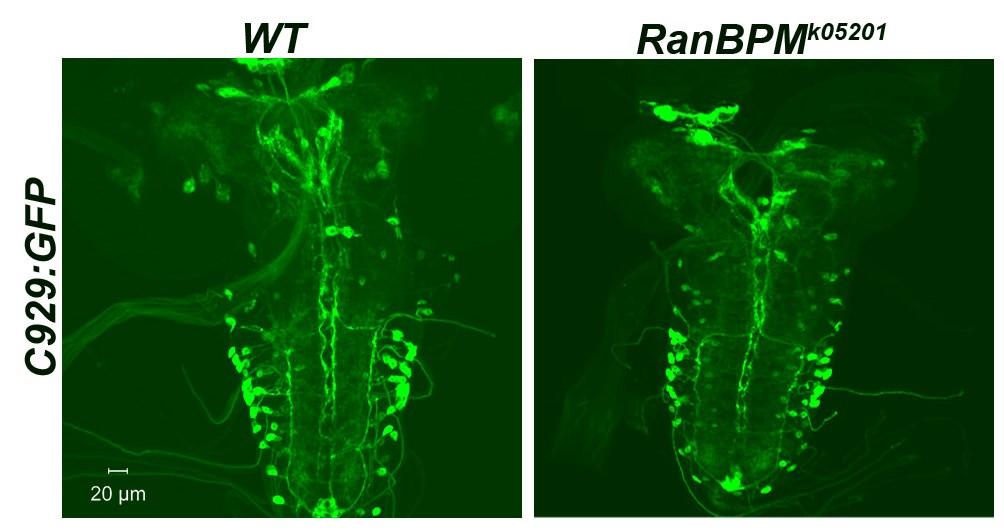 Additional file 2 While the RanBPM mutant CNS (right panel) is smaller than wild type controls (left panel) the overall pattern of