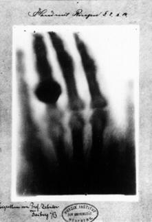 X-rays penetrate tissue and do not scatter much.