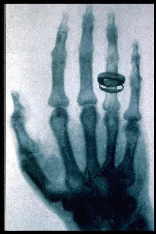the tube and produced x-rays.