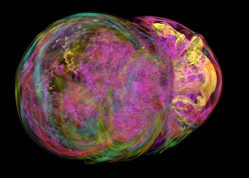 A core-collapse supernova explodes because