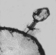9 Mitochondrion mitochondrion Lysosome lysosome Golgi