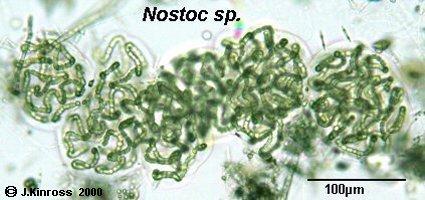 The individual Cyanobacteria are the small, filamentous cells inside