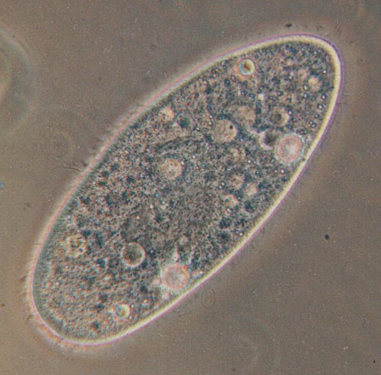 Like all ciliates, these protozoans have more than one nucleus, which